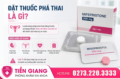 Đặt thuốc phá thai là gì?