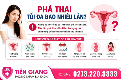 Phá thai tối đa bao nhiêu lần?