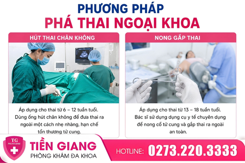 Các phương pháp phá thai ngoại khoa hiện nay.