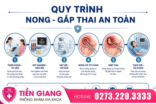 Quy trình thực hiện nong - gắp thai an toàn hiện nay.