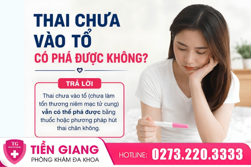 Phá thai khi thai chưa vào tổ có được không?