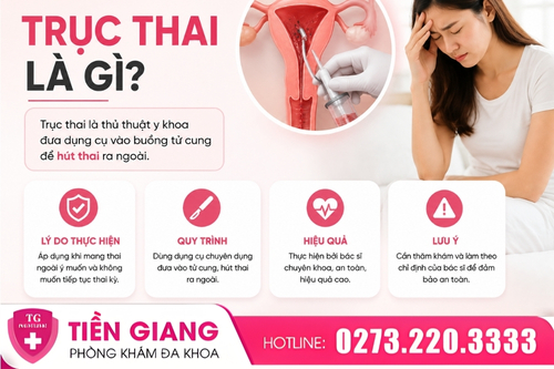 Trục thai là gì?